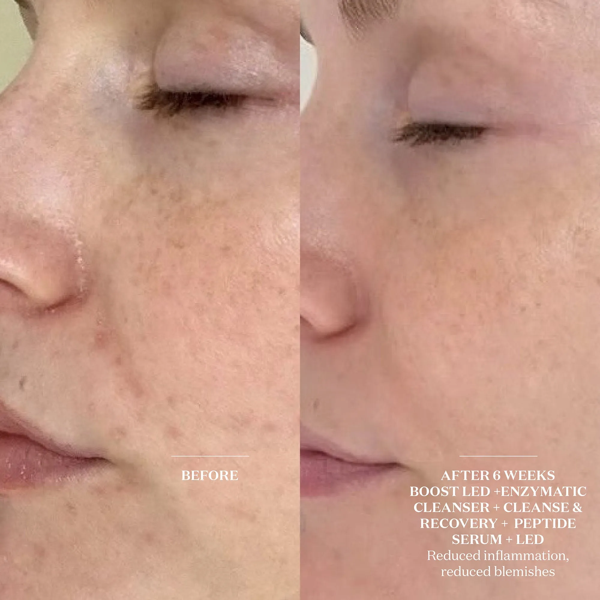 Cleanse and Recovery Spray