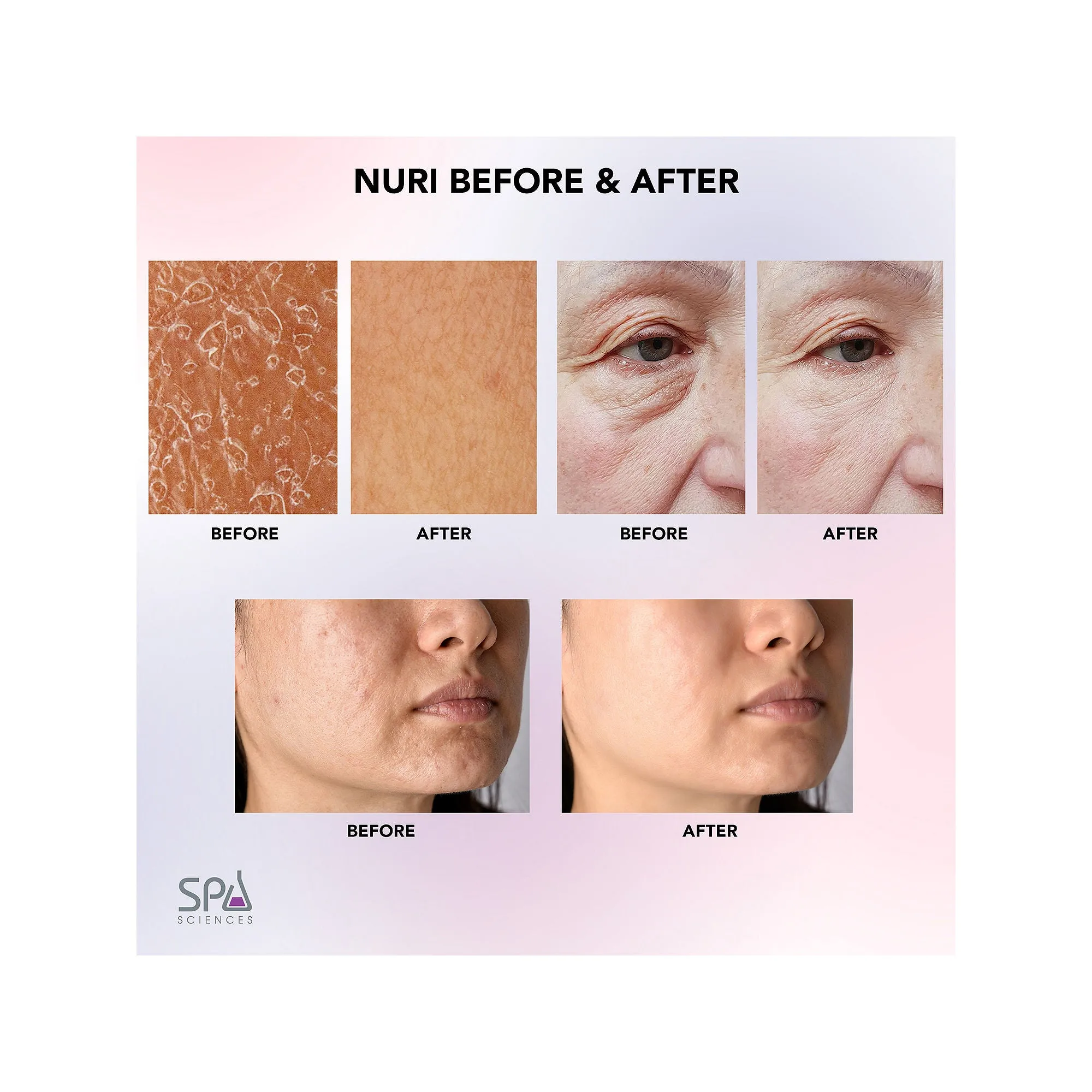 Spa Sciences 82021951 Nuri LED Thermal Smart Facial Skincare Mask Infuser, Pink